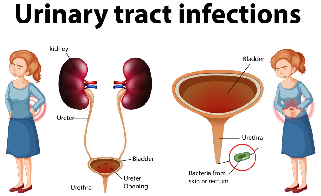 Urinate Frequently Could be Sign of This Disease