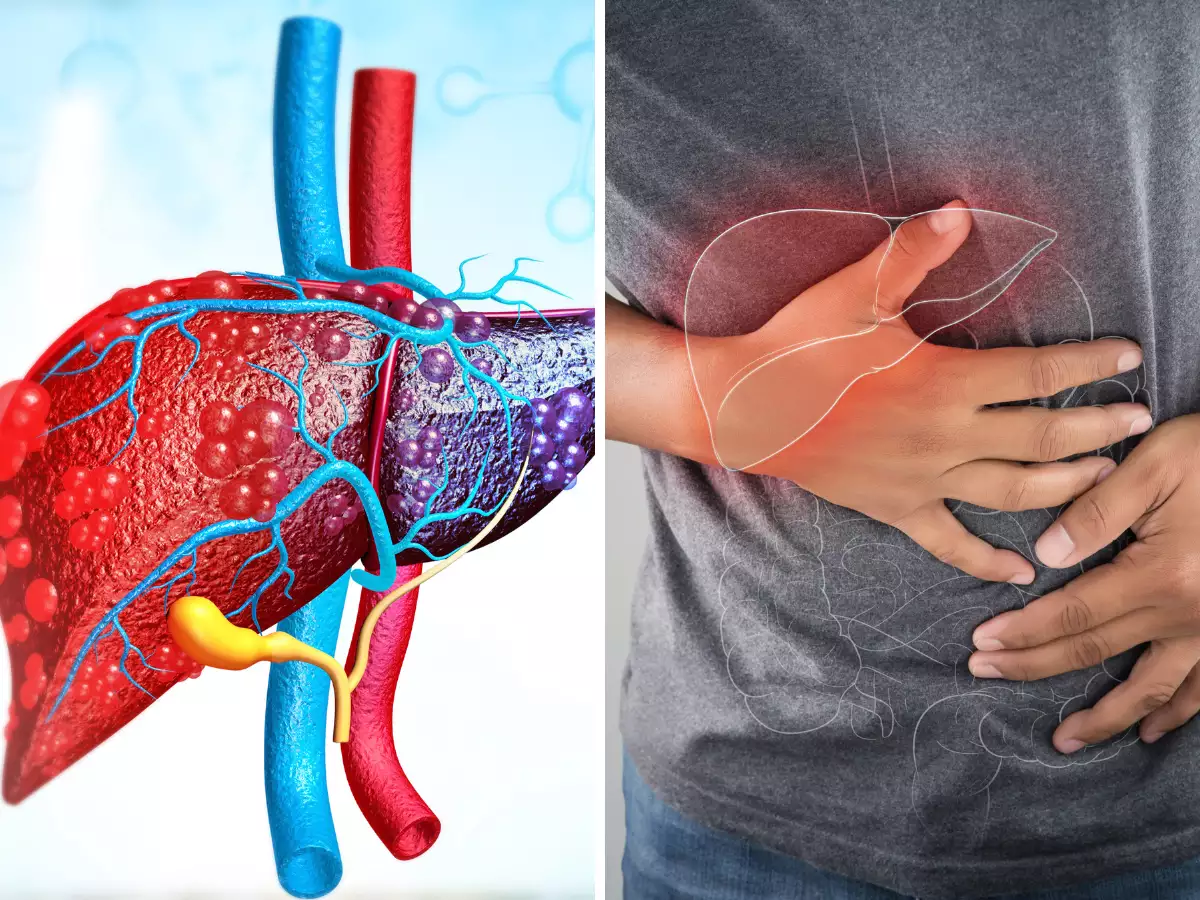 Lliver Damage Symptoms: 5 Tips To Keep Liver Healthy